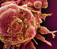 Lynn Waldrop - Novel Coronavirus (COVID-19)